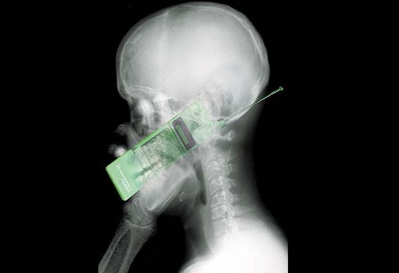 Can cell phones cause cancer essay titles