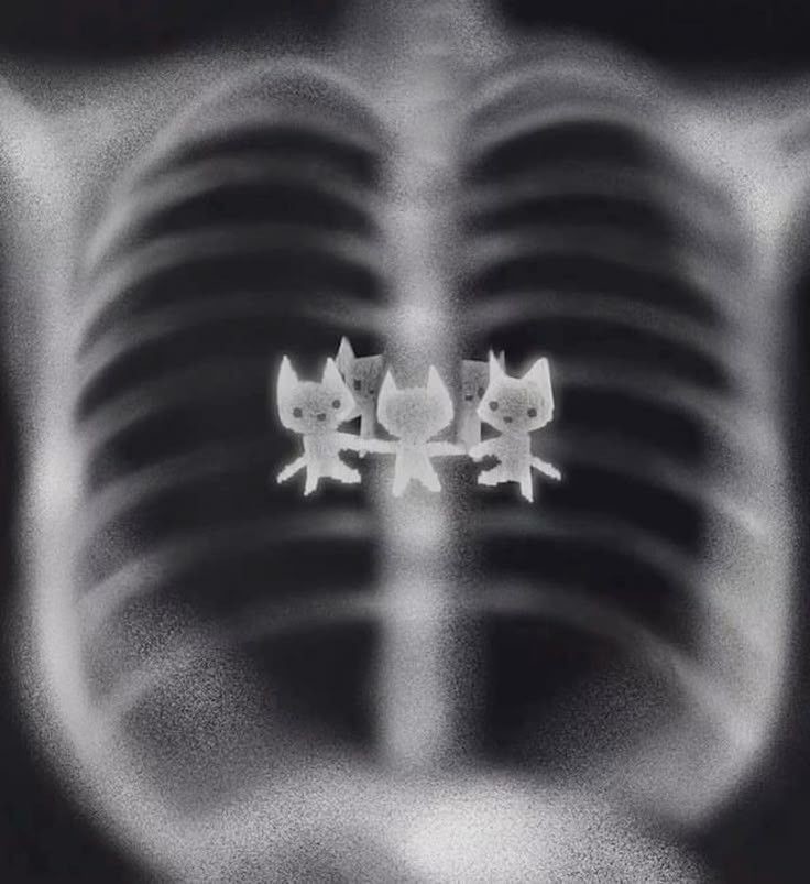 твой убийца