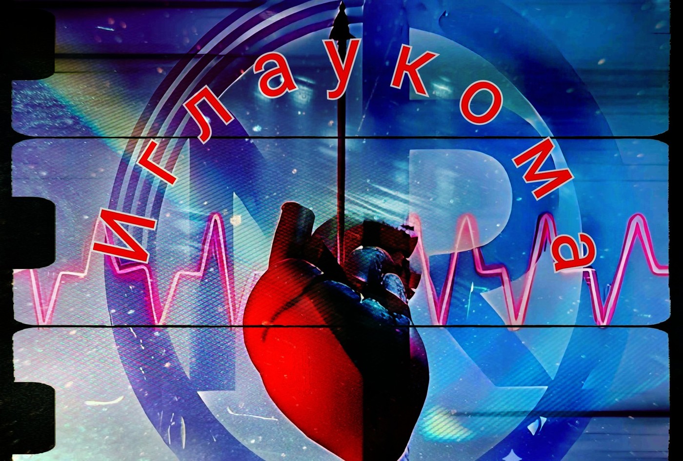 NR Nicholas Ray & Leonid Pettrov & Guacamole! - Иглаукома episode artwork