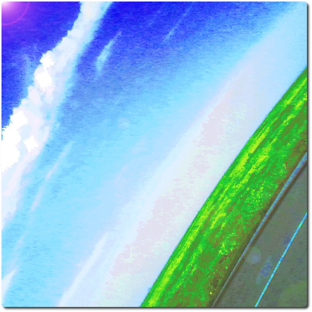 DenSkin8s - Prjt1 (SVM100)